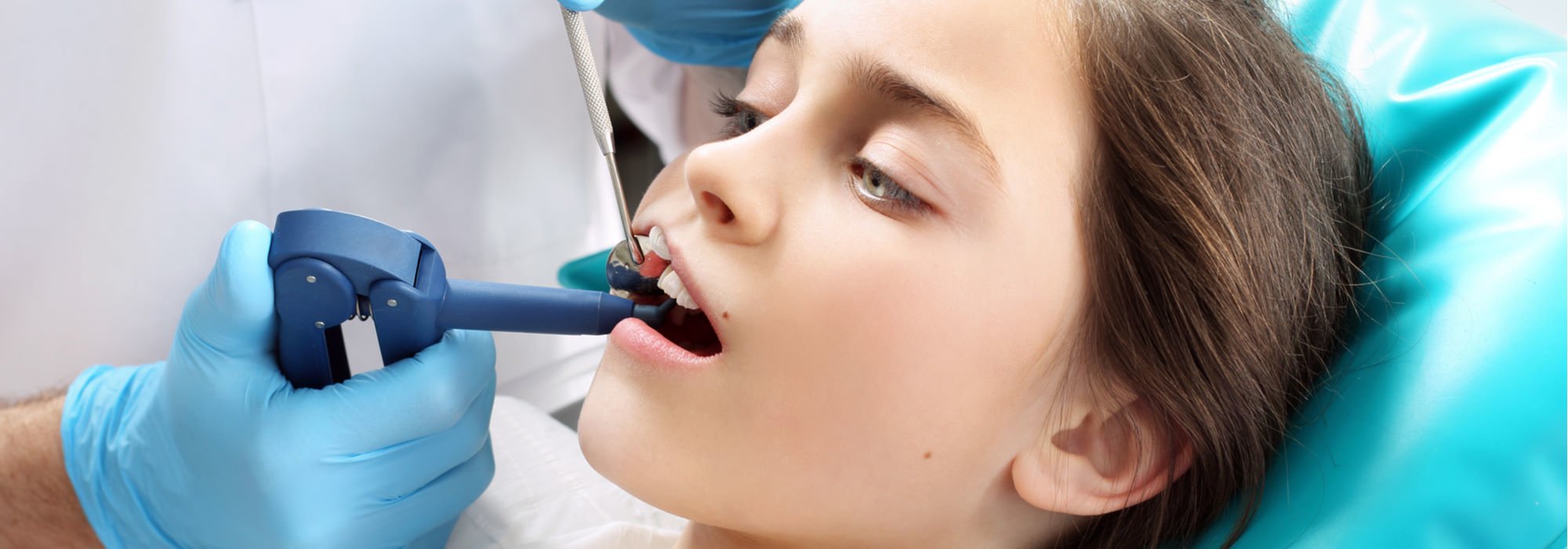 The 411 On Dental Sealants For Your Child Springs Pediatric Dental Care