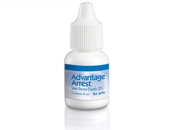 Silver Diamine Fluoride Treatment